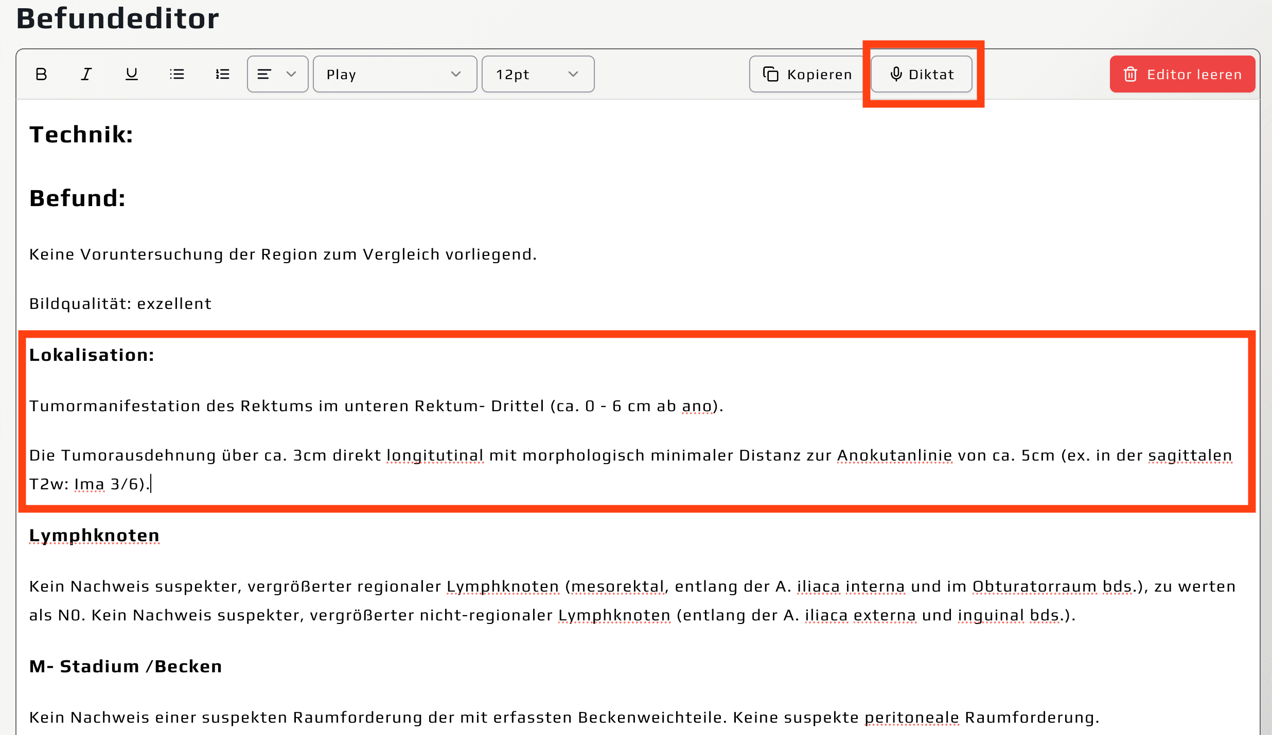 Template image for template4